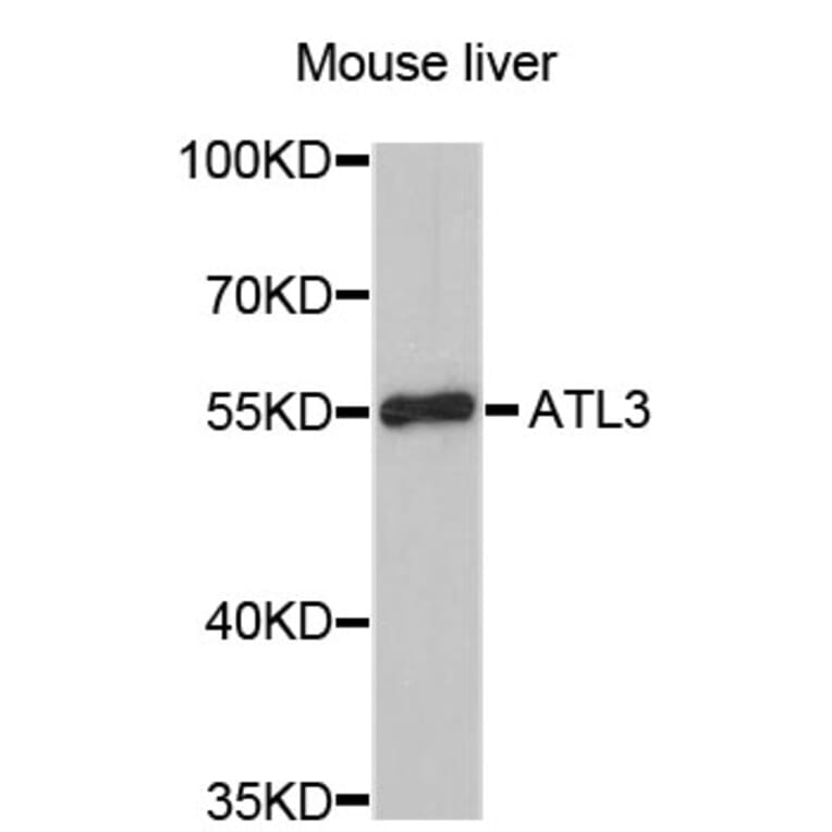 Western Blot - Anti-ATL3 Antibody (A4594) - Antibodies.com