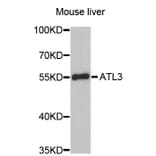 Western Blot - Anti-ATL3 Antibody (A4594) - Antibodies.com
