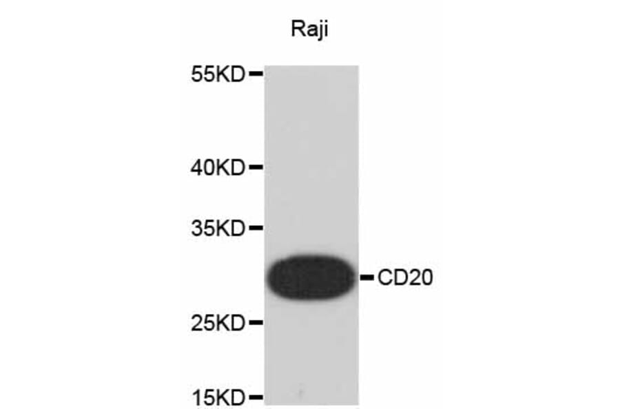 Western Blot - Anti-MS4A1 Antibody (A10792) - Antibodies.com