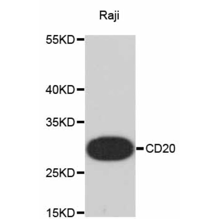 Western Blot - Anti-MS4A1 Antibody (A10792) - Antibodies.com
