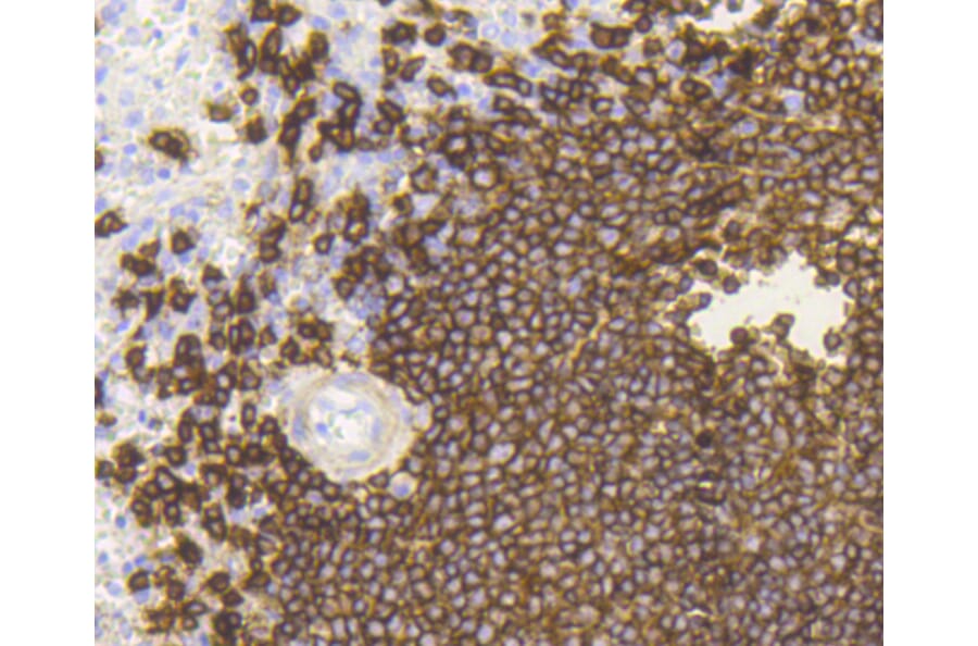 Immunohistochemistry - Anti-MS4A1 Antibody (A10792) - Antibodies.com
