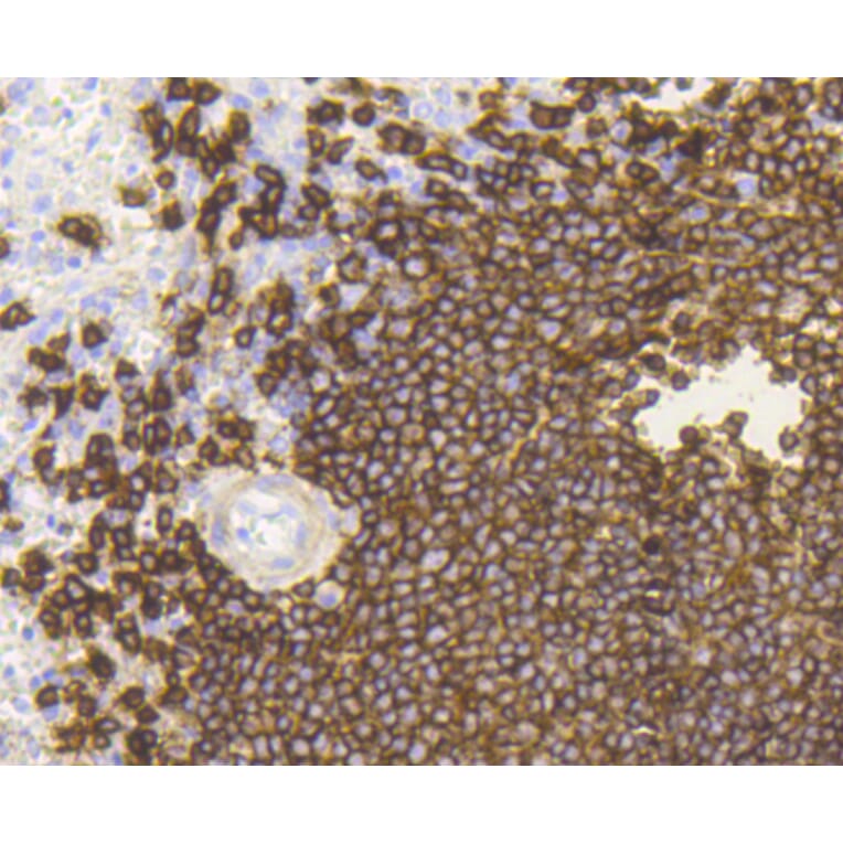 Immunohistochemistry - Anti-MS4A1 Antibody (A10792) - Antibodies.com
