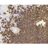 Immunohistochemistry - Anti-MS4A1 Antibody (A10792) - Antibodies.com