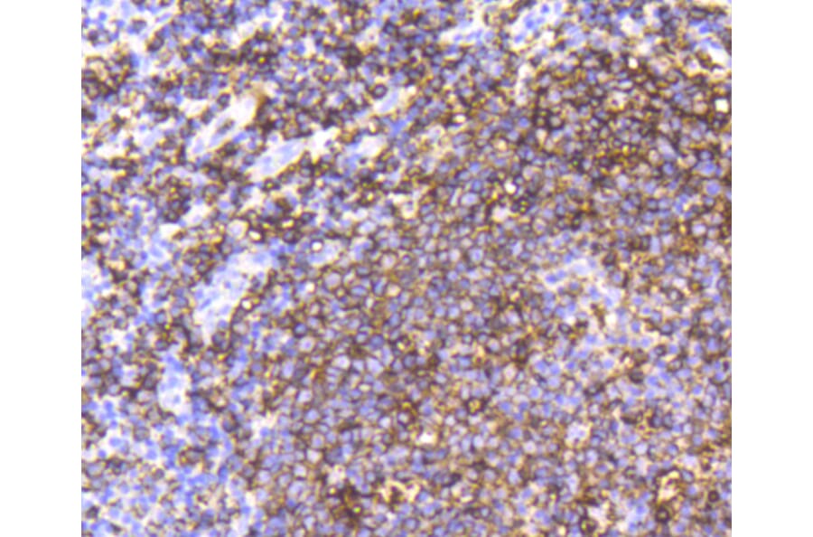 Immunohistochemistry - Anti-MS4A1 Antibody (A10792) - Antibodies.com