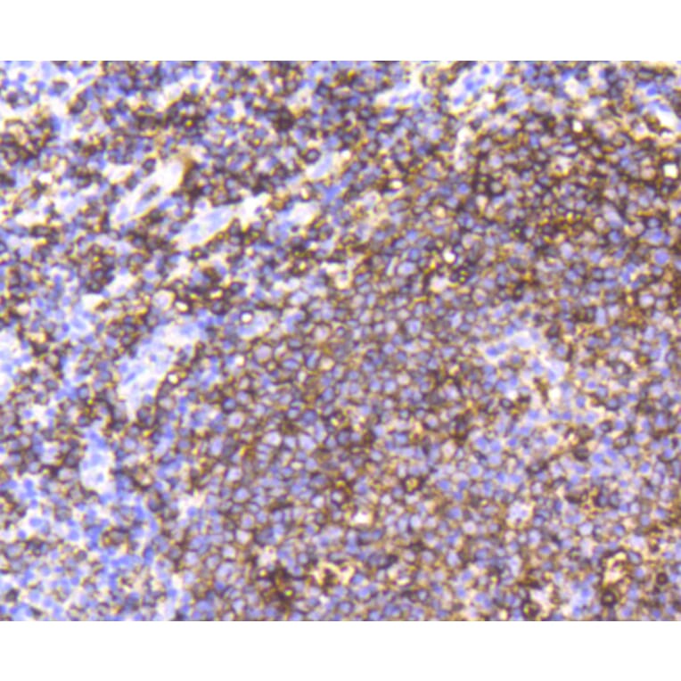 Immunohistochemistry - Anti-MS4A1 Antibody (A10792) - Antibodies.com