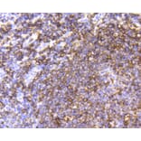 Immunohistochemistry - Anti-MS4A1 Antibody (A10792) - Antibodies.com