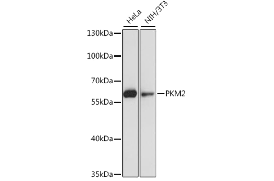Western Blot - Anti-PKM2 Antibody (A7158) - Antibodies.com