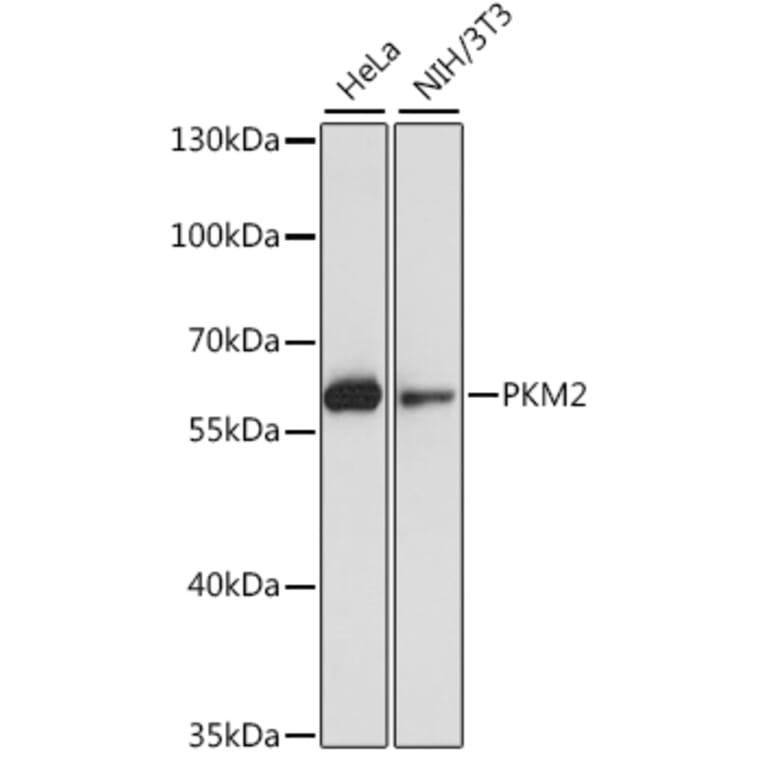 Western Blot - Anti-PKM2 Antibody (A7158) - Antibodies.com