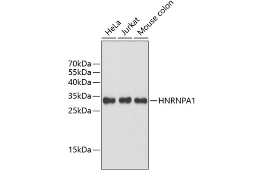 Western Blot - Anti-HNRNPA1 Antibody (A2622) - Antibodies.com