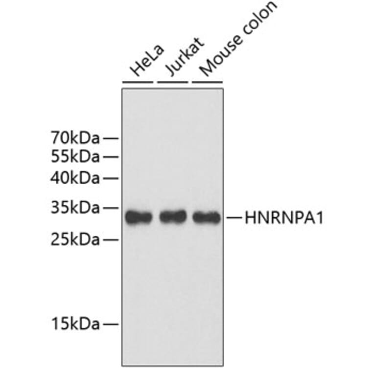 Western Blot - Anti-HNRNPA1 Antibody (A2622) - Antibodies.com