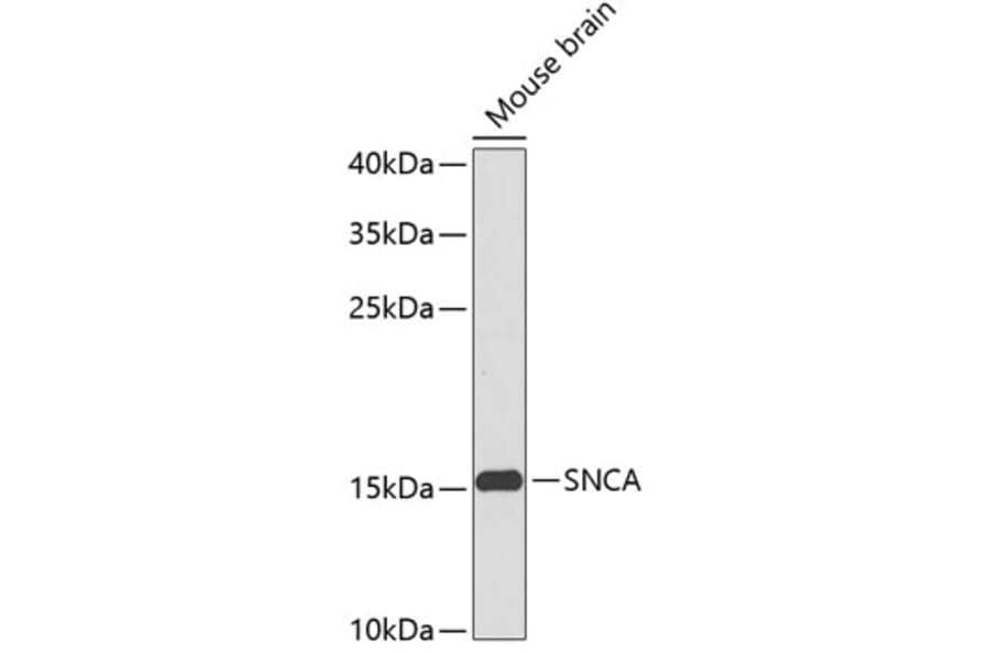 Western Blot - Anti-SNCA Antibody (A0012) - Antibodies.com