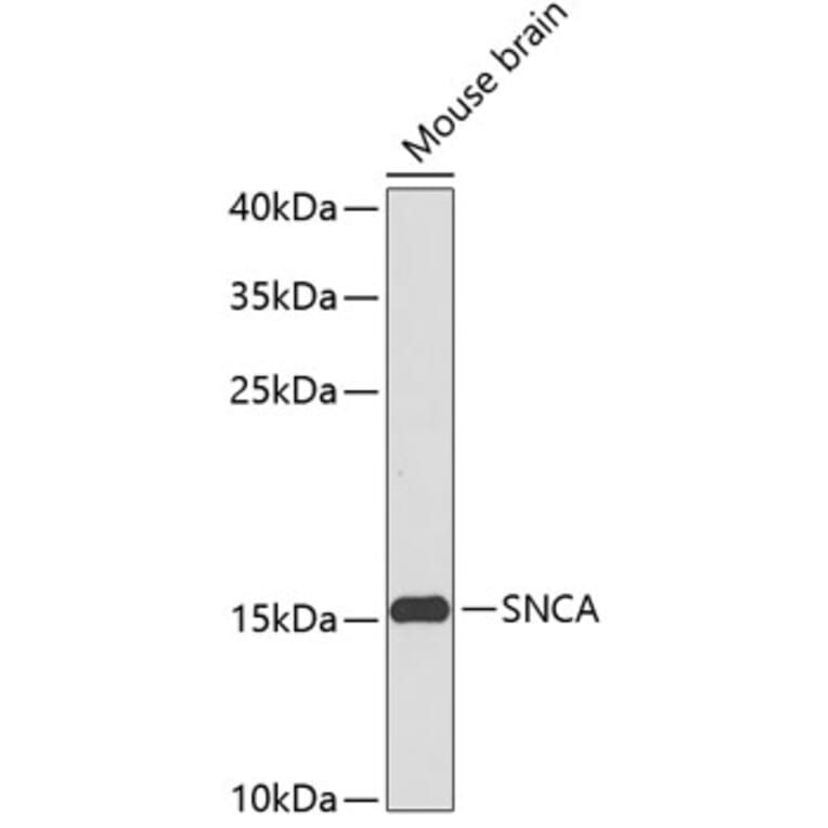 Western Blot - Anti-SNCA Antibody (A0012) - Antibodies.com
