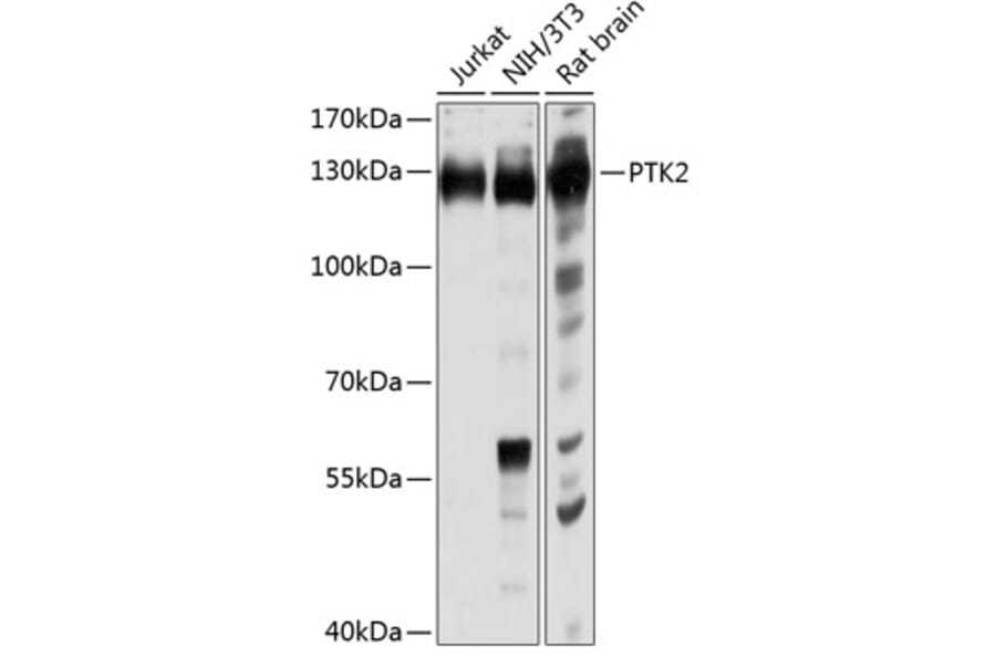 Western Blot - Anti-PTK2 Antibody (A0024) - Antibodies.com