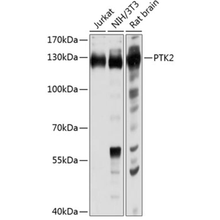 Western Blot - Anti-PTK2 Antibody (A0024) - Antibodies.com
