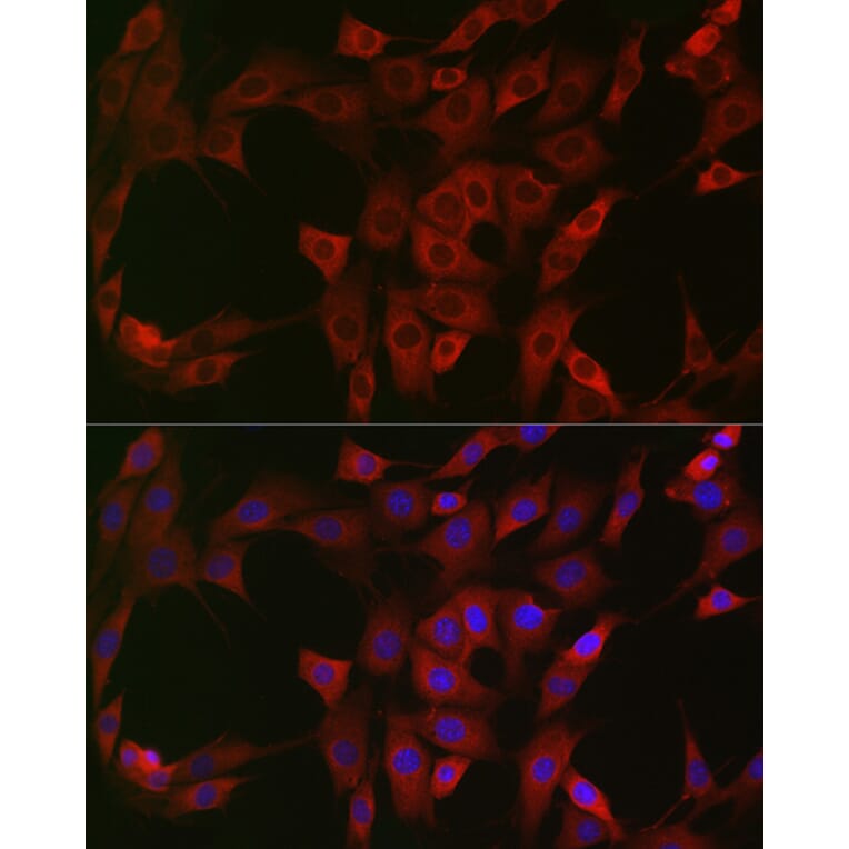 Immunofluorescence - Anti-NQO1 Antibody (A12506) - Antibodies.com