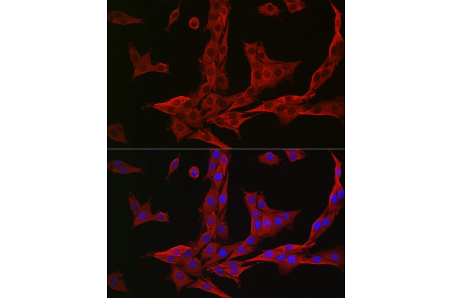 Immunofluorescence - Anti-NQO1 Antibody (A12506) - Antibodies.com