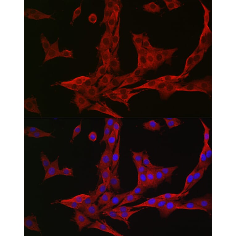 Immunofluorescence - Anti-NQO1 Antibody (A12506) - Antibodies.com
