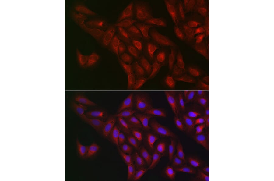 Immunofluorescence - Anti-NQO1 Antibody (A12506) - Antibodies.com