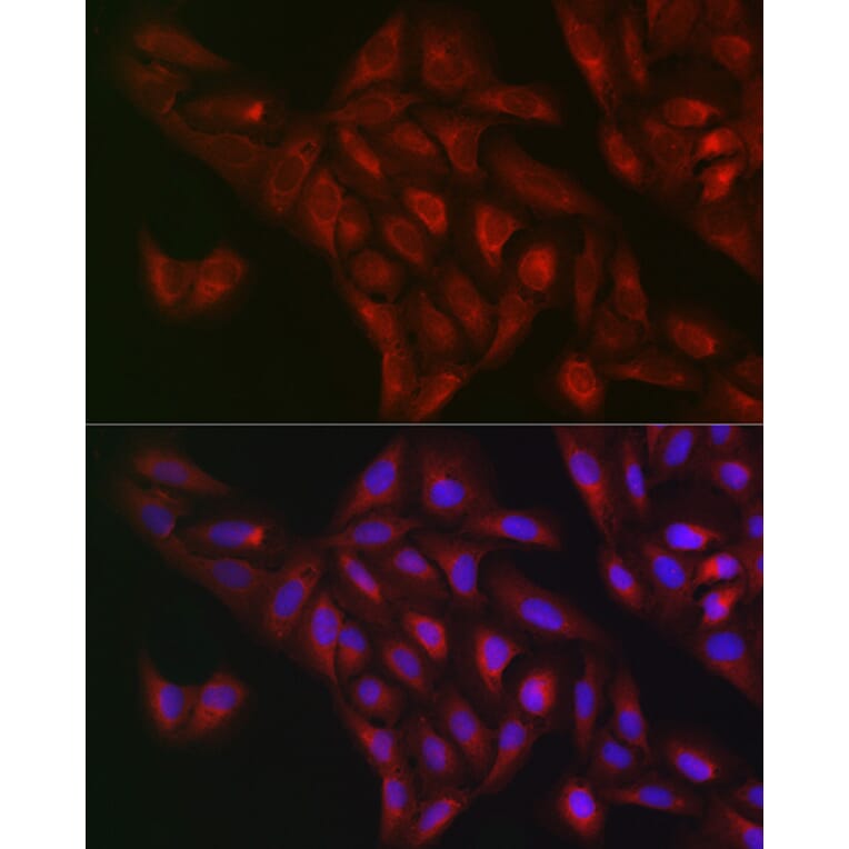 Immunofluorescence - Anti-NQO1 Antibody (A12506) - Antibodies.com