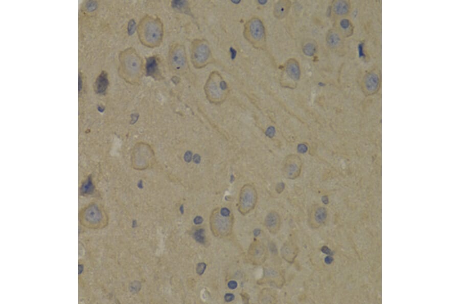 Immunohistochemistry - Anti-PI 3 Kinase p85 alpha Antibody (A12507) - Antibodies.com