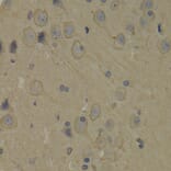 Immunohistochemistry - Anti-PI 3 Kinase p85 alpha Antibody (A12507) - Antibodies.com