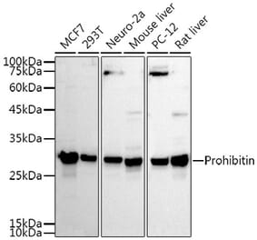 Western Blot - Anti-Prohibitin Antibody (A12508) - Antibodies.com