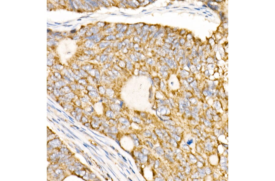 Immunohistochemistry - Anti-Prohibitin Antibody (A12508) - Antibodies.com
