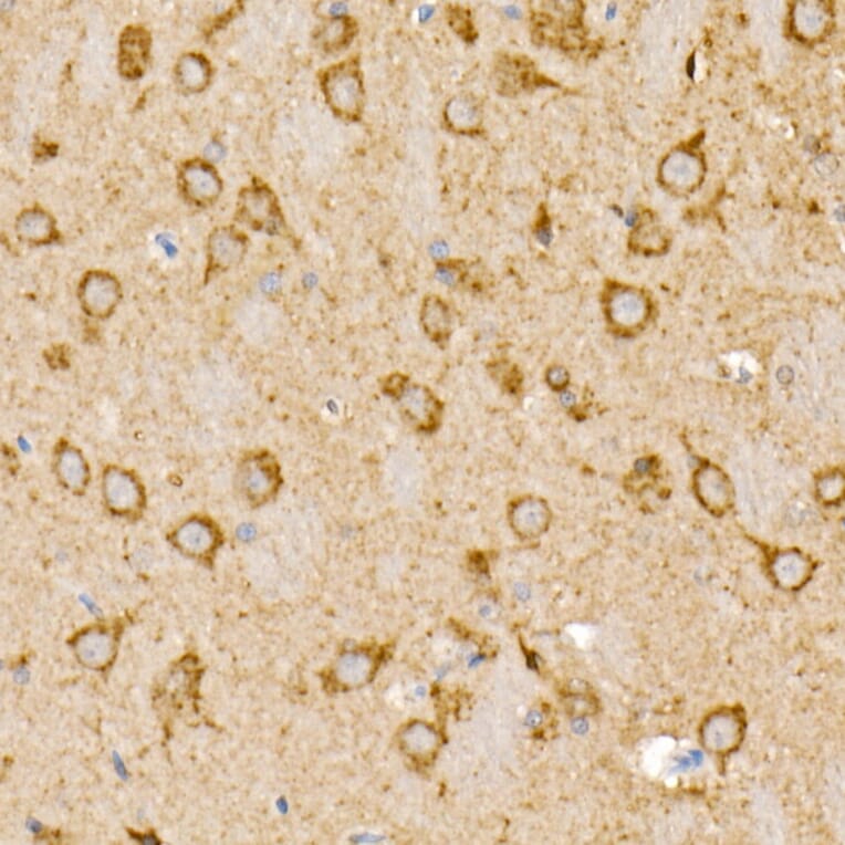 Immunohistochemistry - Anti-Prohibitin Antibody (A12508) - Antibodies.com