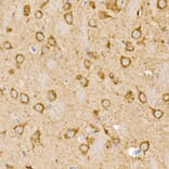 Immunohistochemistry - Anti-Prohibitin Antibody (A12508) - Antibodies.com