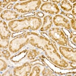 Immunohistochemistry - Anti-Prohibitin Antibody (A12508) - Antibodies.com