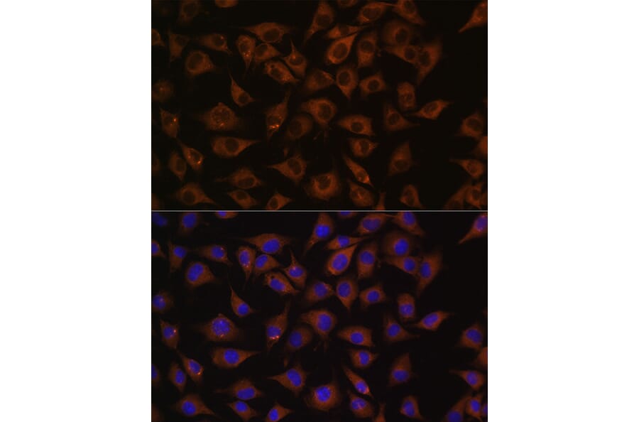 Immunofluorescence - Anti-Prohibitin Antibody (A12508) - Antibodies.com