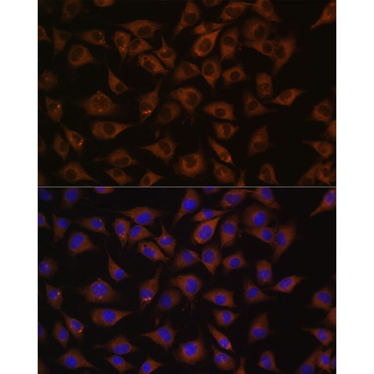 Immunofluorescence - Anti-Prohibitin Antibody (A12508) - Antibodies.com