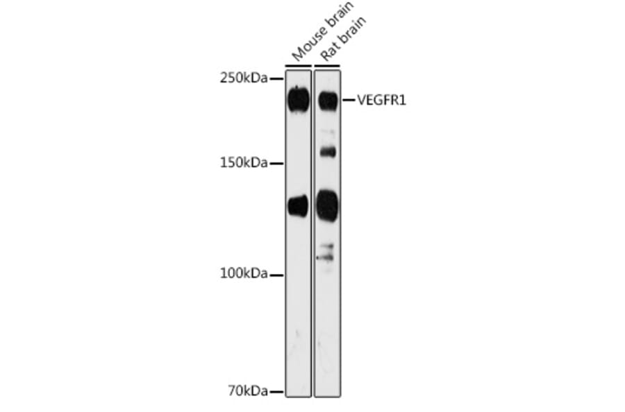 Western Blot - Anti-VEGF Receptor 1 Antibody (A12509) - Antibodies.com