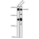 Western Blot - Anti-VEGF Receptor 1 Antibody (A12509) - Antibodies.com