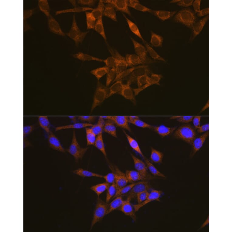 Immunofluorescence - Anti-VEGF Receptor 1 Antibody (A12509) - Antibodies.com