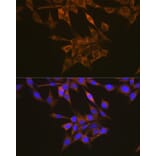 Immunofluorescence - Anti-VEGF Receptor 1 Antibody (A12509) - Antibodies.com