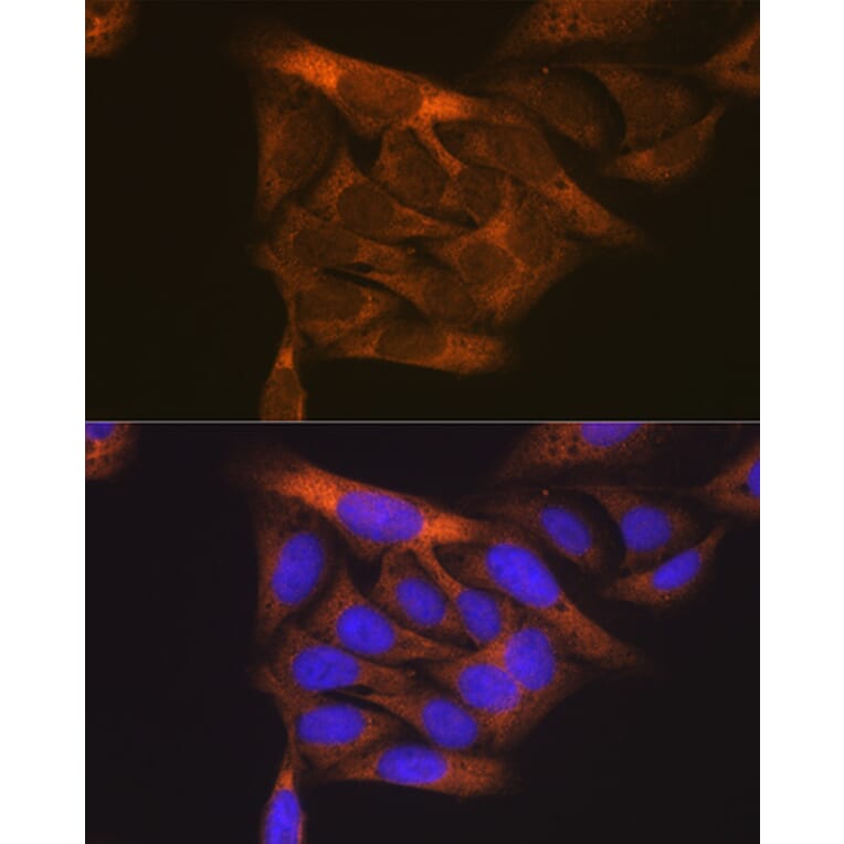 Immunofluorescence - Anti-VEGF Receptor 1 Antibody (A12509) - Antibodies.com
