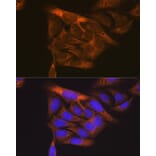 Immunofluorescence - Anti-VEGF Receptor 1 Antibody (A12509) - Antibodies.com