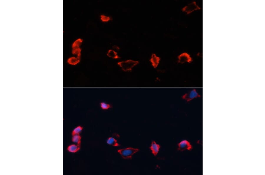 Immunofluorescence - Anti-Caveolin 1 Antibody (A12510) - Antibodies.com