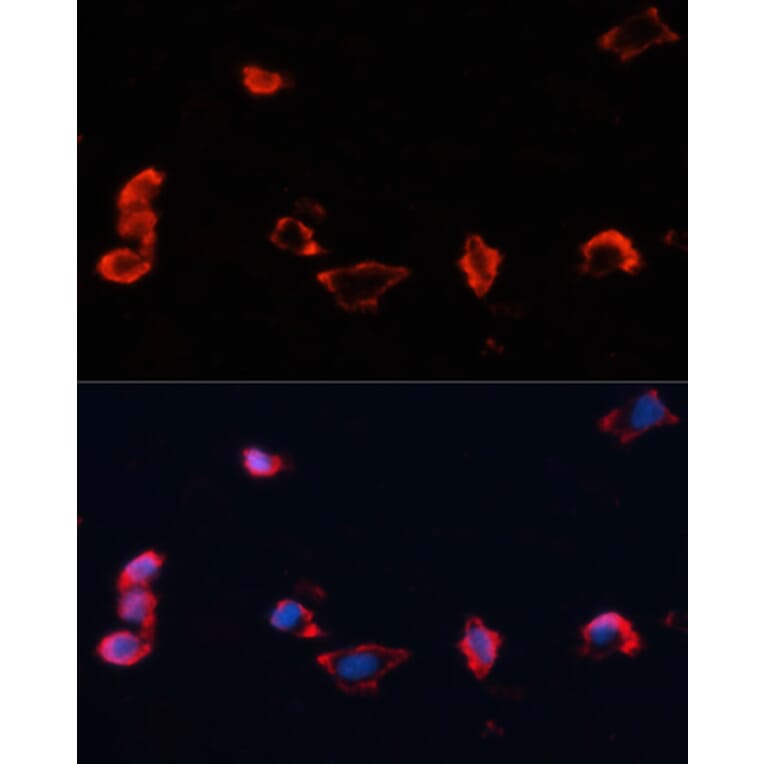 Immunofluorescence - Anti-Caveolin 1 Antibody (A12510) - Antibodies.com