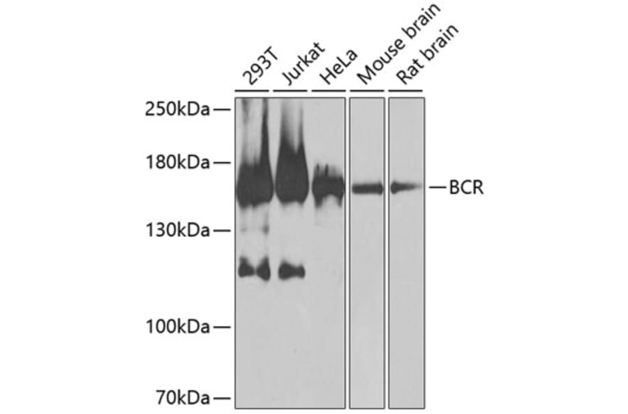 Western Blot - Anti-Bcr Antibody (A12512) - Antibodies.com