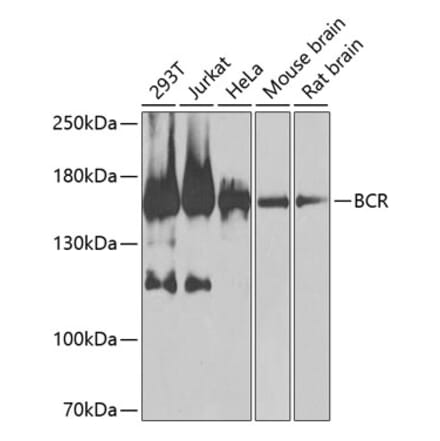 Western Blot - Anti-Bcr Antibody (A12512) - Antibodies.com