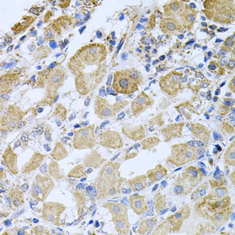 Immunohistochemistry - Anti-Bcr Antibody (A12512) - Antibodies.com