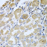 Immunohistochemistry - Anti-Bcr Antibody (A12512) - Antibodies.com