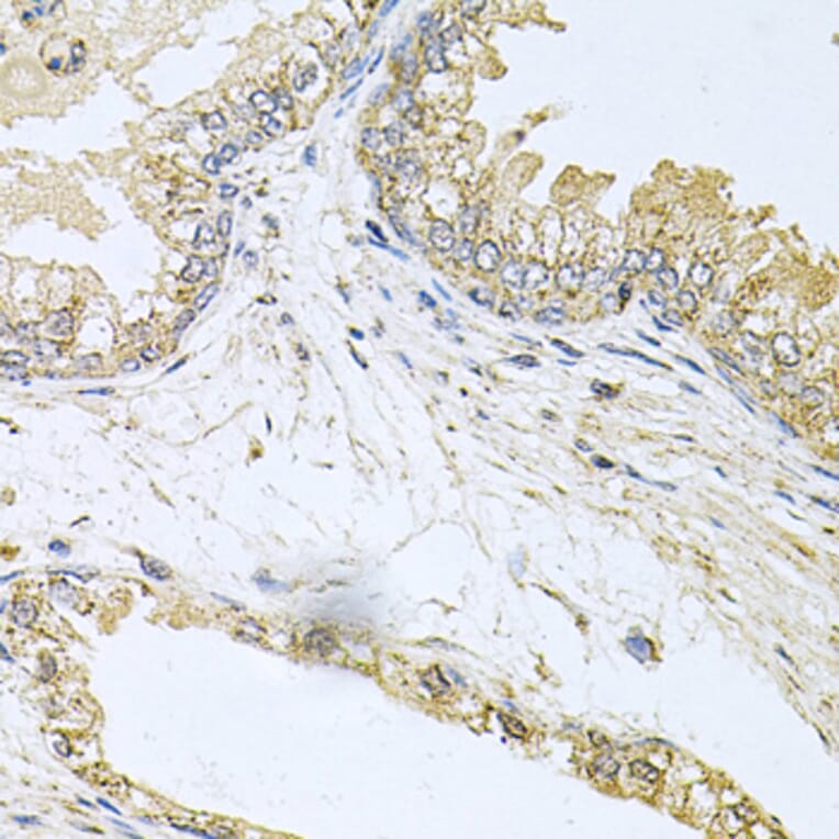 Immunohistochemistry - Anti-Bcr Antibody (A12512) - Antibodies.com
