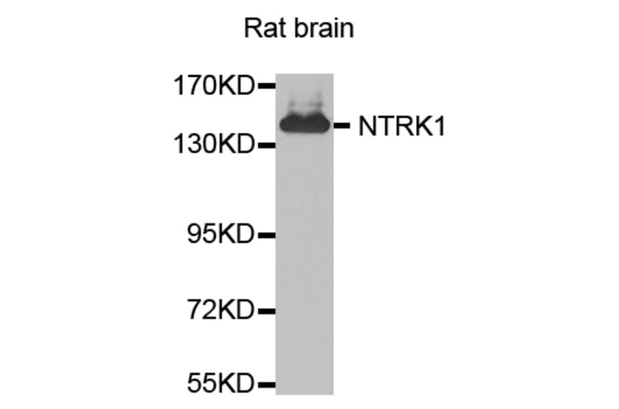 Western Blot - Anti-NTRK1 Antibody (A0072) - Antibodies.com