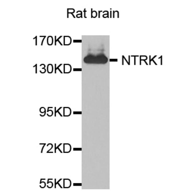 Western Blot - Anti-NTRK1 Antibody (A0072) - Antibodies.com