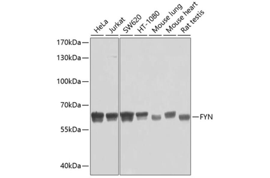 Western Blot - Anti-FYN Antibody (A0086) - Antibodies.com