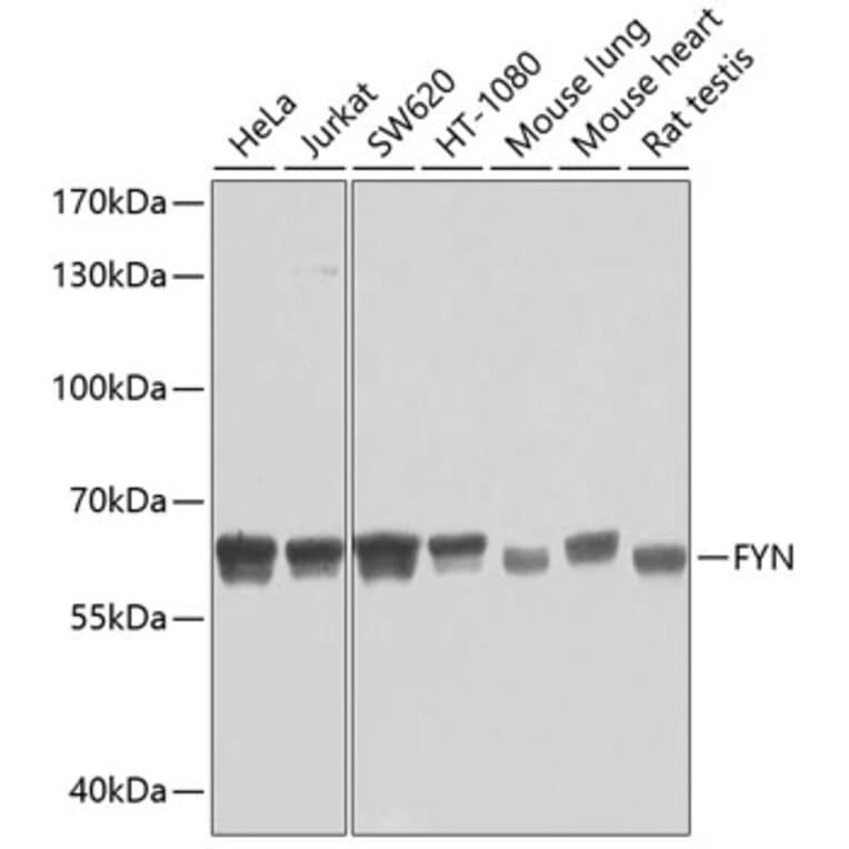 Western Blot - Anti-FYN Antibody (A0086) - Antibodies.com