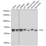 Western Blot - Anti-FYN Antibody (A0086) - Antibodies.com